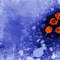 US awards no-bid contract to Denmark scientists studying hepatitis B vaccine in African babies